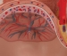 Pelvis de embarazo (3 piezas)