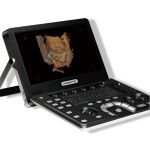 Producto recomendado - ultrasonido