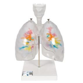 Árbol bronquial TAC con laringe y pulmón transparente