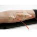 Brazo avanzado para prácticas con pulso arterial y zonas de punción SMASH S402.100