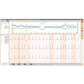 Software Cardioline Cubeholter para análisis de registros Holter de hasta 9 días